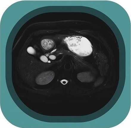 mri MRCP  anatomy icon